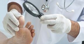 The doctor examines the leg affected by the fungus
