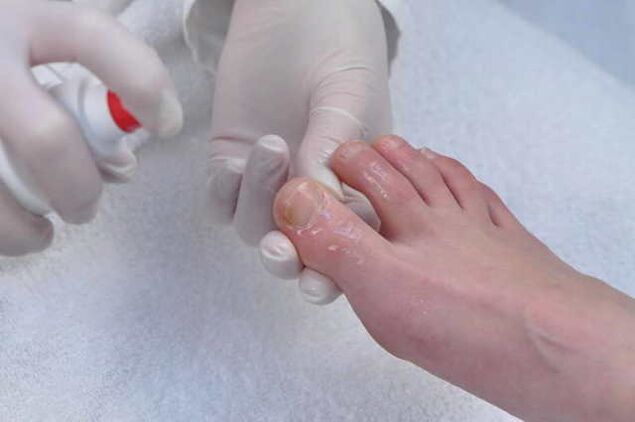 Feeling of treatment