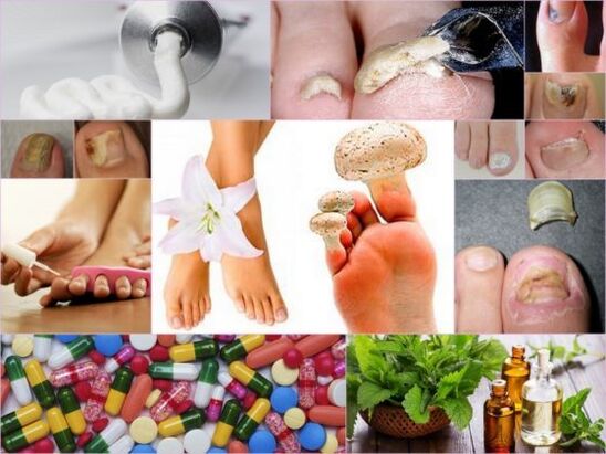 Folk remedies